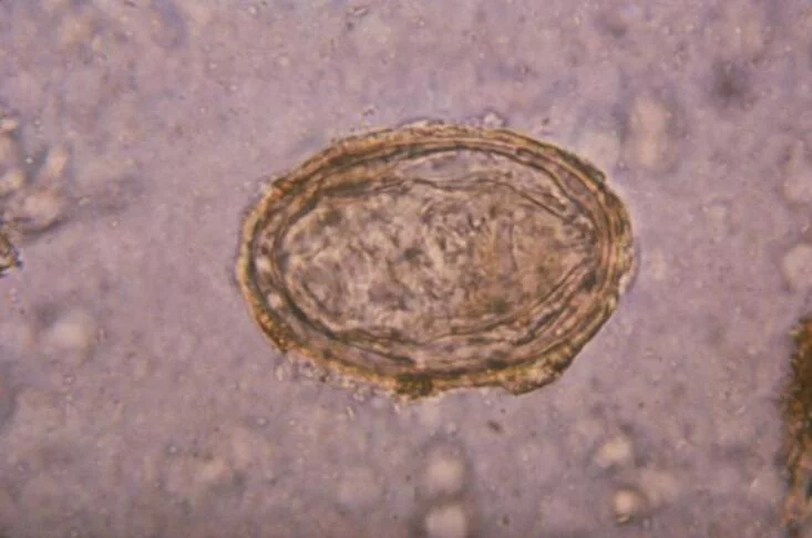 Schistosoma haematobium: Parasita causador da esquistossomose urinária, doença que causa sangramento urinário e outros problemas geniturinários. Transmissão ocorre pelo contato com água doce contaminada com larvas. 