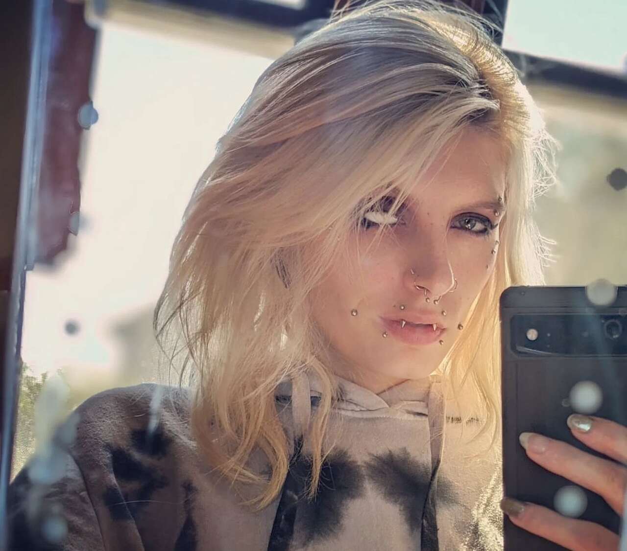 Bree explicou em suas redes sociais que utiliza próteses porque perdeu o olho após ser diagnosticada um tipo raro de câncer: melanoma ocular.