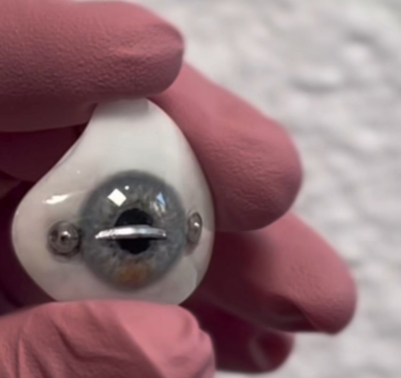 A resposta para essas perguntas é bem simples. Bree não tem um globo ocular e o olho, na verdade, trata-se de uma prótese.