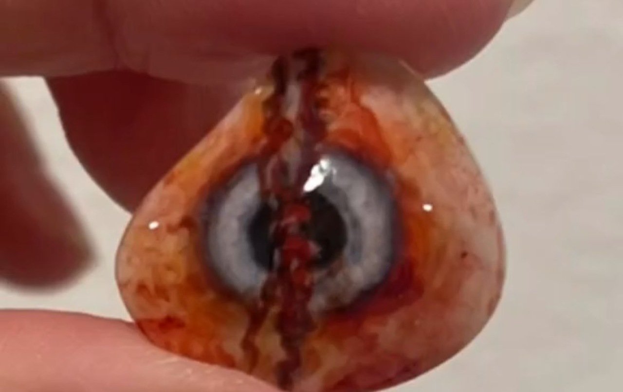 'É precisa achar o ocularista certo, que é perfeito para você, que faz a prótese que você quer e a faz se moldar perfeitamente ao formato do seu olho', ela alerta.