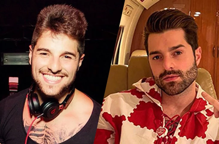 O DJ goiano Alok postou o resultado do procedimento, que foi focado no queixo. 