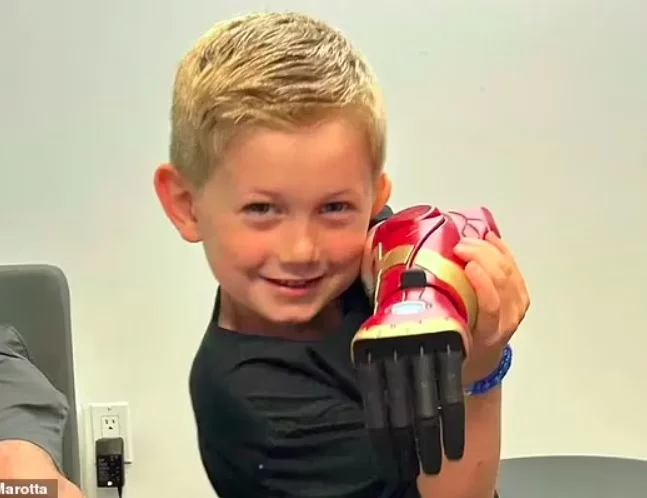 Ainda segundo a fabricante, a prótese funciona com uma bateria recarregável que dura cerca de 14 horas.