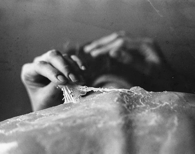 A SSJ é caracterizada pelo aparecimento súbito de erupções cutâneas graves, bolhas e descamação da pele.