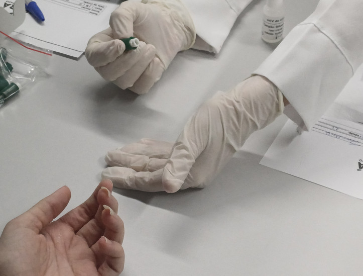 Testagem rápida de hepatite B e C foi realizada durante o 