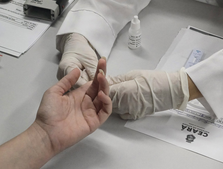 Testagem rápida de hepatite B e C foi realizada durante o 