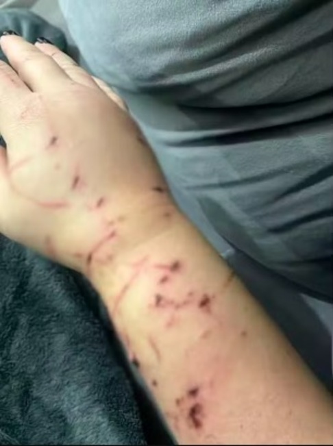 A  agressividade do bicho resultou em ferimentos graves na família e fez com que Luciana e suas filhas de 22 e 16 anos precisassem até se esconder em seus quartos.