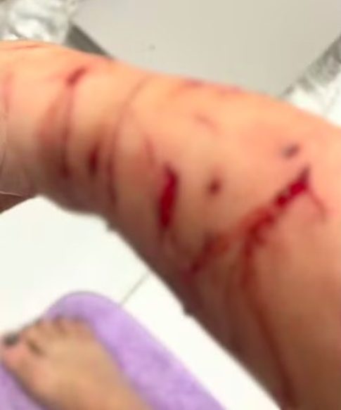 De lá para cá, Thor já cometeu inúmeros ataques, mordendo ou agarrando a perna das pessoas. O último ataque a Luciana foi considerado grave e o gato já tinha provocado ferimentos semelhantes pelo menos outras 10 vezes.