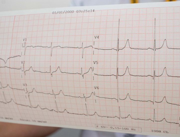 FORTALEZA, CEARÁ, BRASIL, 10-08-2024: Prefeitura realiza mutirão de saúde para detectar doenças cardiovasculare no Posto de saúde Pio XII.  (Foto: Samuel Setubal/ O Povo)