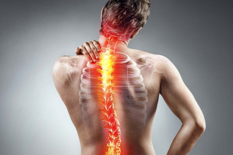 A escoliose é a curvatura anormal da coluna vertebral, mas pode ser detectada e tratada precocemente para evitar complicações (Imagem: RomarioIen| Shutterstock)
