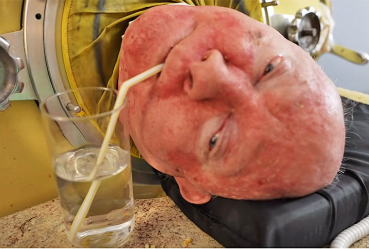 Como precisava ficar o tempo todo dentro da máquina, Paul recebia cuidados e precisava ser alimentado por alguém.