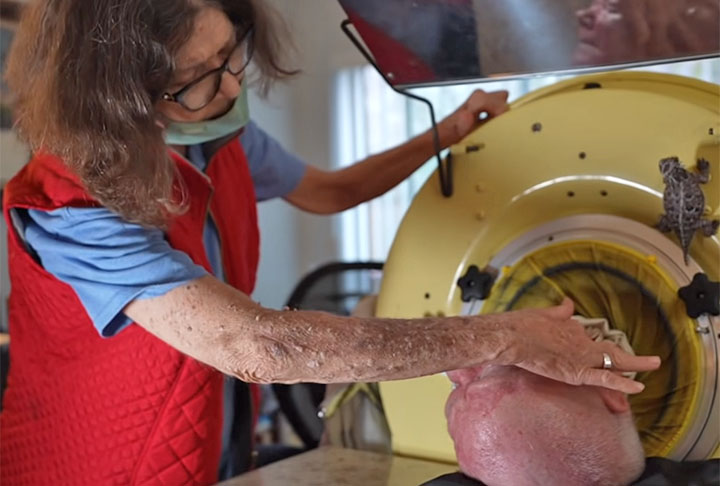 Paul relatou em uma entrevista ao portal do Guinness Book, que quando sua mãe viu seu rosto, quando ainda era criança, ela soube que algo estava errado, embora ele não soubesse explicar como percebeu isso.