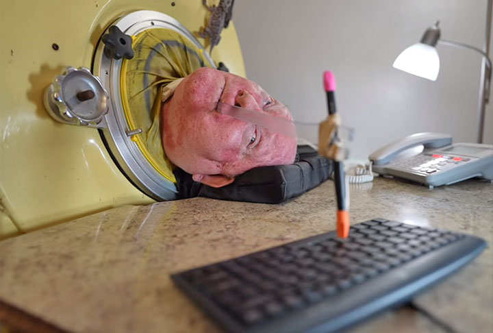 Aos poucos, Alexander também aprendeu a escrever segurando uma caneta presa a um pedaço de pau com a boca.