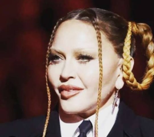 A cantora virou motivo de piada nas redes sociais por exagerar no tratamento estético de rejuvenescimento. O rosto inchado dela na cerimônia do Grammy de 2023 chamou a atenção e teve grande repercussão.