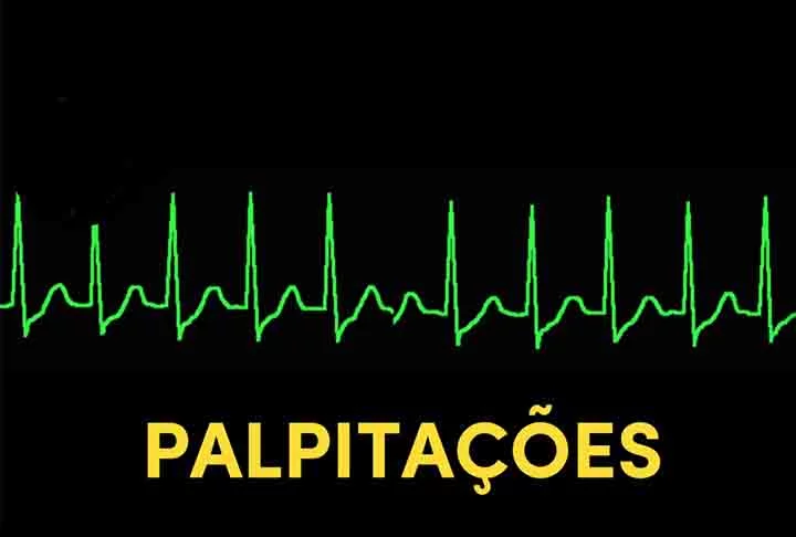É preciso destacar que boa parte das arritmias não tem uma causa bem definida, sendo algumas de nascença. Outras são em virtude de problemas no músculo do coração, como infarto, insuficiência cardíaca ou doença de Chagas. 