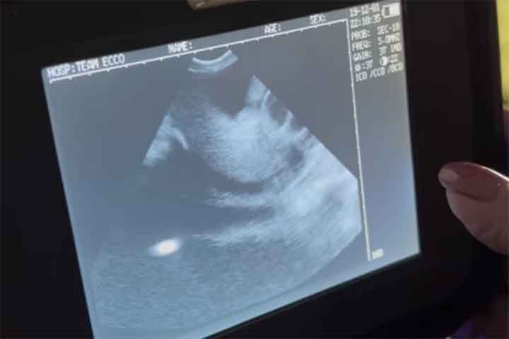 Batizada de Charlotte, a arraia de cor parda ficou grávida de quatro filhotes. Charlotte não mostra comportamentos incomuns ou mudanças nos padrões alimentares. Paciência é o jogo agora, destacou o aquário em suas redes sociais. 