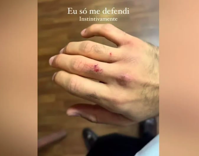 Em uma postagem nas redes sociais, Medina mostrou a mão machucada e escreveu: “Eu só me defendi instintivamente.