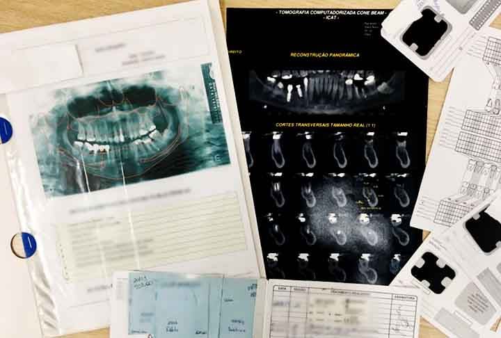 A identificação foi realizada por meio de exame odontológico, que comparou a arcada dentária do corpo com a ficha odontológica da vítima.