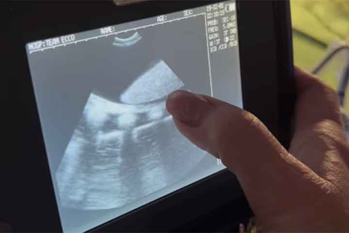 Em suas redes sociais, a direção do local compartilhou à época imagens do ultrassom da gravidez “solo” da arraia. 
