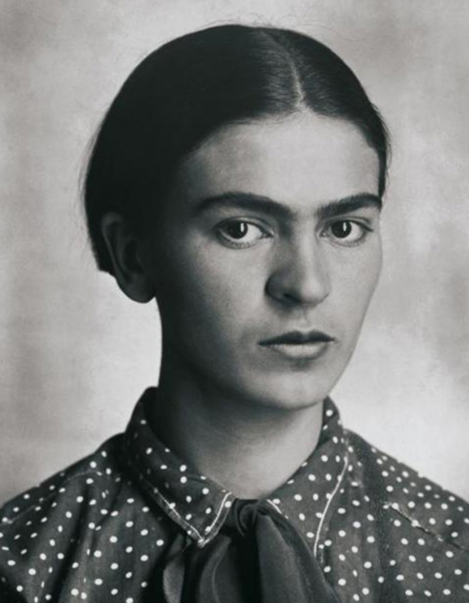 O acidente fez com que Frida passasse por um longo processo de recuperação e precisasse usar um colete pelo resto da vida. 
