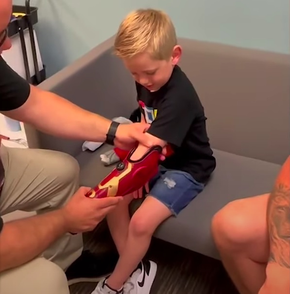 A prótese foi feita sob medida para se encaixar e ser removida facilmente do braço esquerdo do menino.