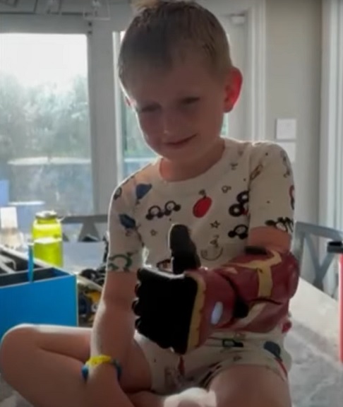 Sensores e eletrodos na prótese detectam os movimentos dos músculos e fazem os dedos e a mão se moverem de acordo. 