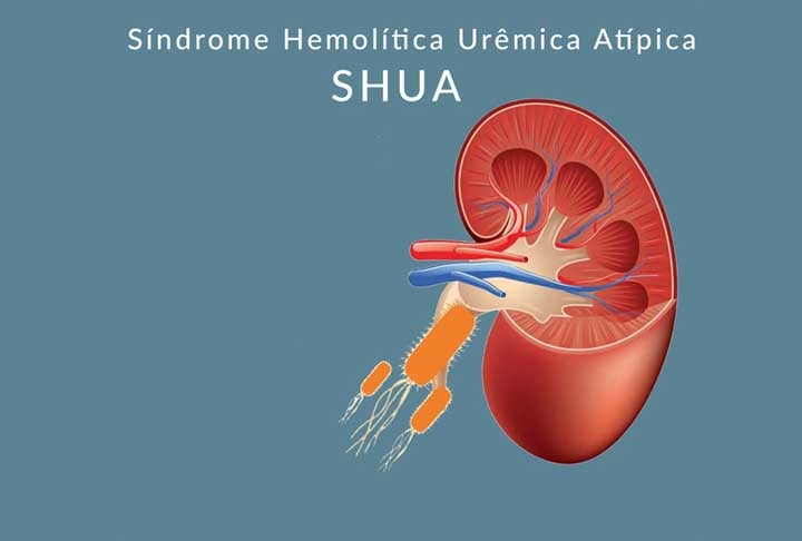 Fomos de UTI aérea para São Paulo e o diagnóstico também demorou. Precisei de hemodiálise e troca de plasma, e acabei tendo o diagnóstico da síndrome, relatou em entrevista.