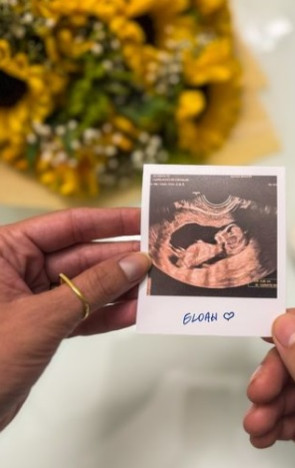 Anúncio da gravidez foi divulgado pelo deputado André Fernandes nas redes sociais