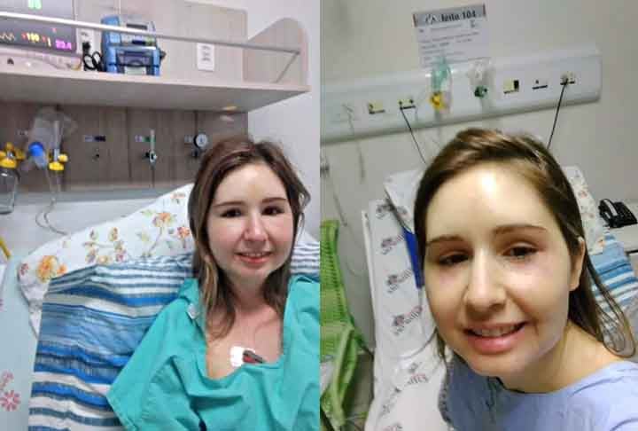 Uma doença rara tem causado dificuldade entre os médicos para fazer um diagnóstico preciso. É a SHUa (Síndrome Hemolítico Urêmica Atípica), que segundo o Comitê de Doenças Raras da Sociedade Brasileira de Nefrologia, atinge 2 a 5 pessoas a cada milhão no planeta.