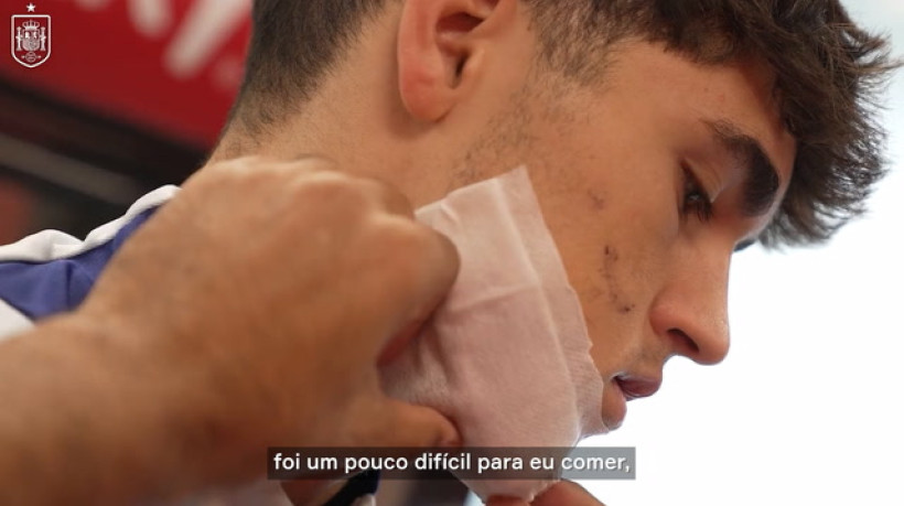 Pau Cubarsí mostra curativo após chute no rosto na UEFA Champions League