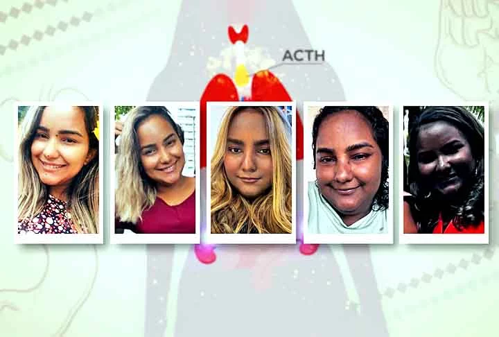 “Eu mudei de coloração muito rápido. Questão de meses, três, quatro meses”, contou Sabrina, referindo-se à pigmentação alterada de pacientes que têm superprodução de ACTH. 
