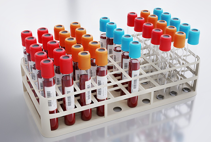 Qual o volume de sangue coletado? Na doação, são retirados no máximo 9ml de sangue por quilo do doador. A pessoa deve pesar pelo menos 50 kg, para uma doação de 450 ml. O máximo de volume a ser doado é de 495ml.