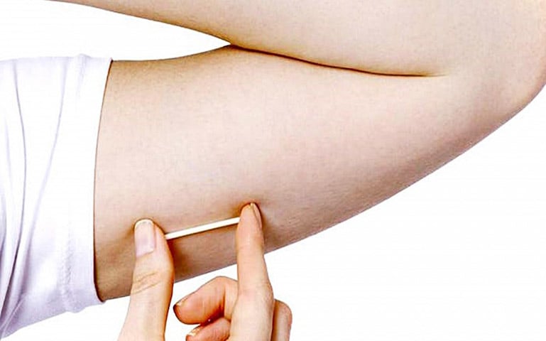 Um exemplo é o chip de gestrinona, amplamente divulgado como tratamento para endometriose, apesar da ausência de pesquisas que confirmem sua eficácia ou segurança.