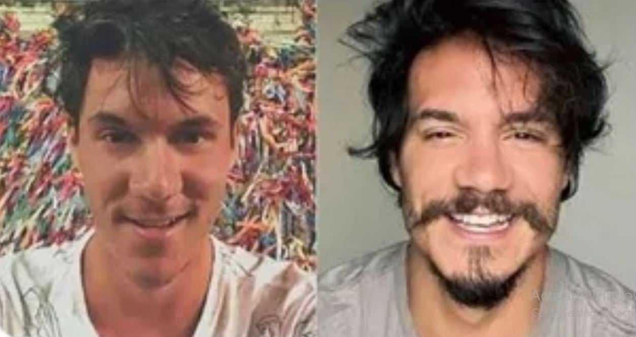 O designer Eliezer, nascido em Volta Redonda (RJ),fez uma série de harmonizações antes de participar do BBB22. Ele disse que achava seu rosto muito fino e o queixo projetado para frente e decidiu gastar R$ 14 mil para harmonizar. Fiquei bonito, festejou. 