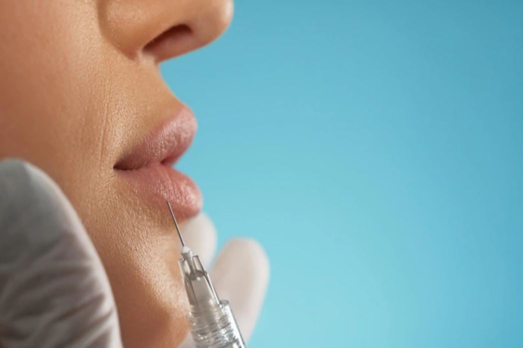 O processo leva de 30 a 60 minutos. Os resultados podem durar de um ano até a vida toda, dependendo do produto escolhido pelo profissional e pelo cliente. No início, há um inchaço na região, mas os resultados começam a aparecer logo depois.