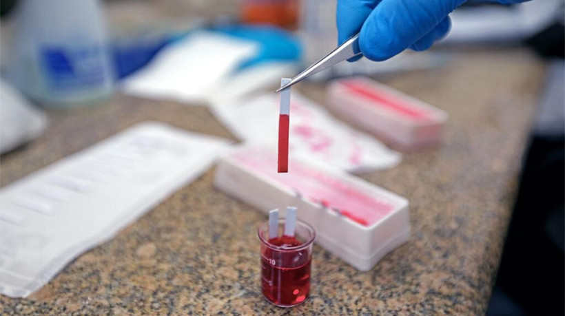 Tecnologia pode gerar teste rápido para detectar vírus HPV, atualmente identificados pelo exame de Papanicolau