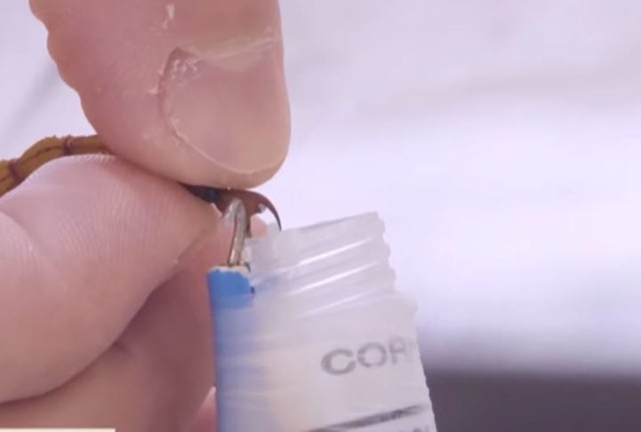 Existe soro específico para o veneno do Tityus serrulatus. Por isso, é importante buscar atendimento médico o mais rápido possível em caso de acidentes.