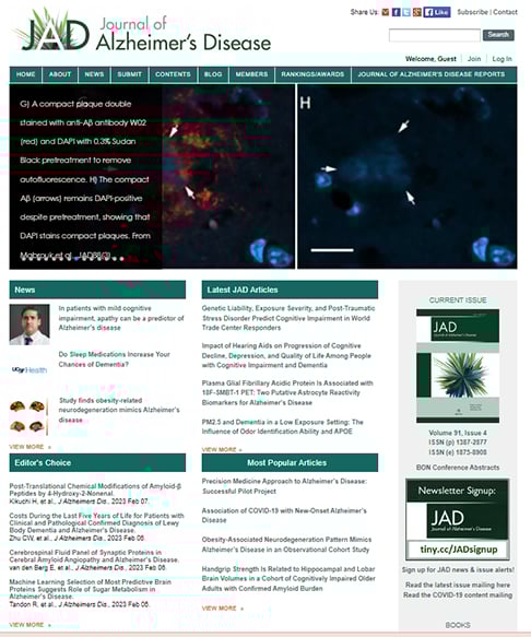 Em janeiro de 2023, um caso publicado na revista Journal of Alzheimer’s Disease teve repercussão, pois informava sobre um caso de Alzheimer num jovem de 19 anos, de identidade não revelada, em Pequim, na China. 
