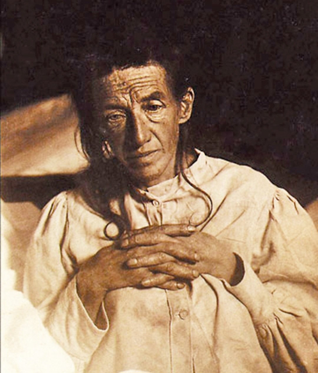 A primeira pessoa diagnosticada com o Mal de Alzheimer foi Auguste Deter, alemã que morrreu em 8/4/1906, aos 55 anos. Nascida em Kassel, em 16/5/1850, ela entrou para a história. Adoeceu em 1901, aos 50 anos, e ficou internada o restante da vida. 