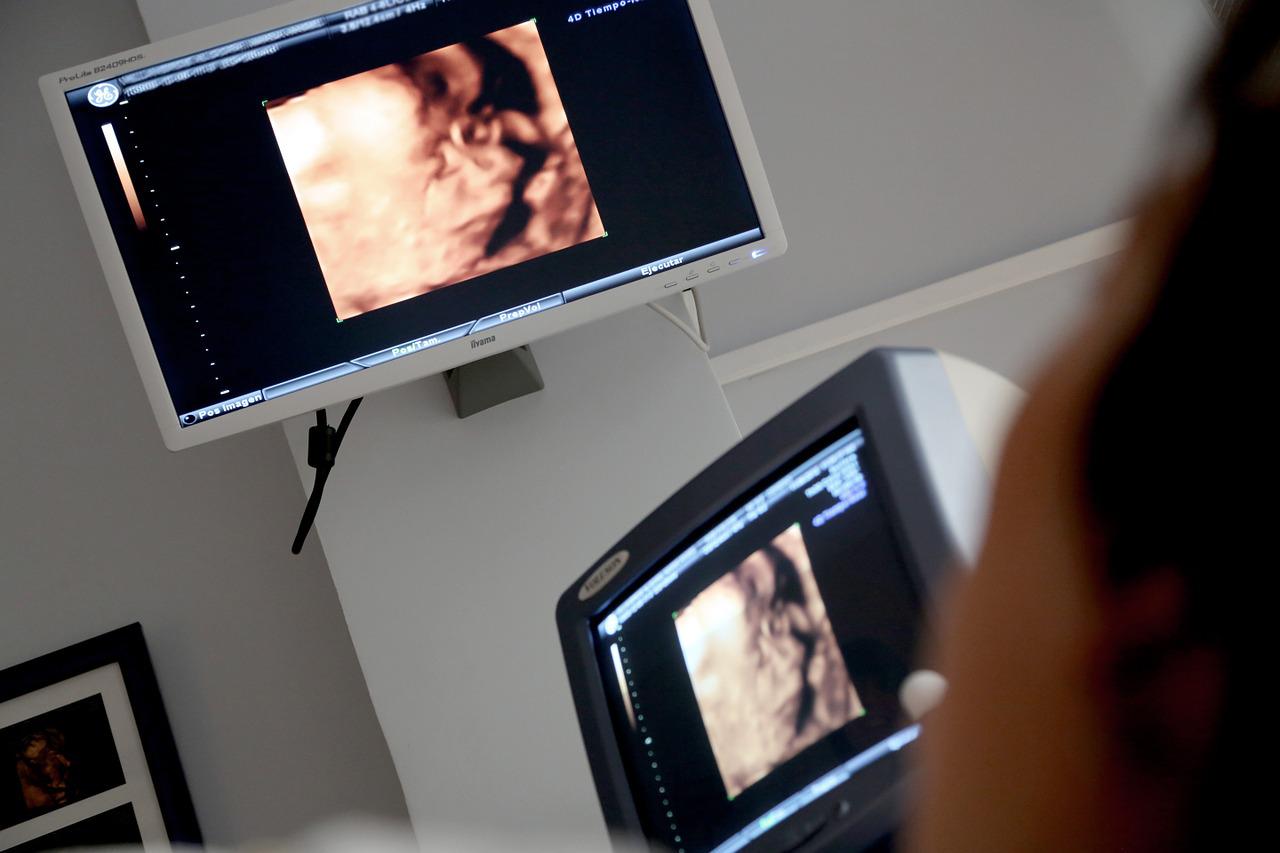  “O ultrassom e a ressonância magnética, sem riscos e desconfortos, fornecem imagens que podem ser impressas em 3D, com o bebê em formação, destaca o Dr. Heron Werner, especialista em Ginecologia, Obstetrícia e Medicina Fetal do CDPI.