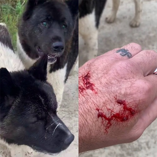 Passado o susto, o australiano chega a mostrar os ferimentos na mão, decorrentes da briga. 