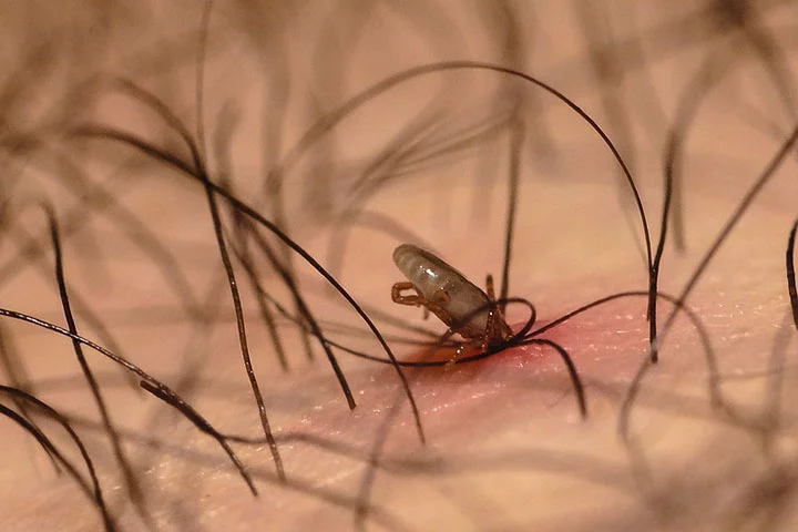 Um programa de banhos regulares com produtos para carrapatos deve ser seguido para eliminar os insetos e evitar novas infestações. 