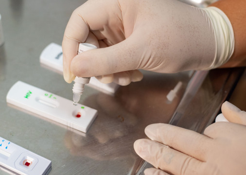 ￼TESTAGEM, preservativo e de profilaxias são formas de prevenir o HIV