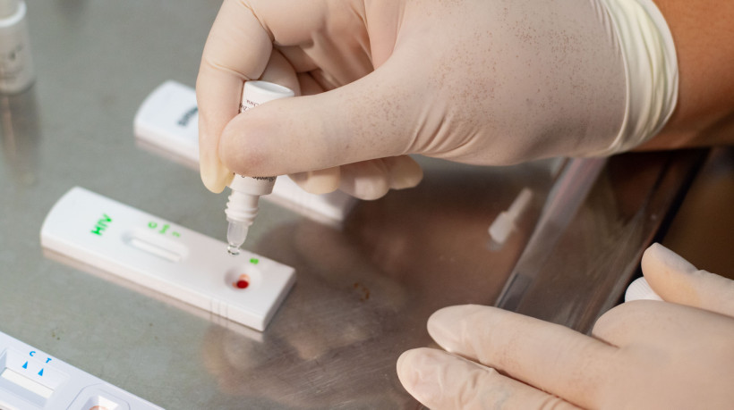 Testagem, uso de preservativo e de profilaxias pré e pós-exposição são formas de prevenir o HIV