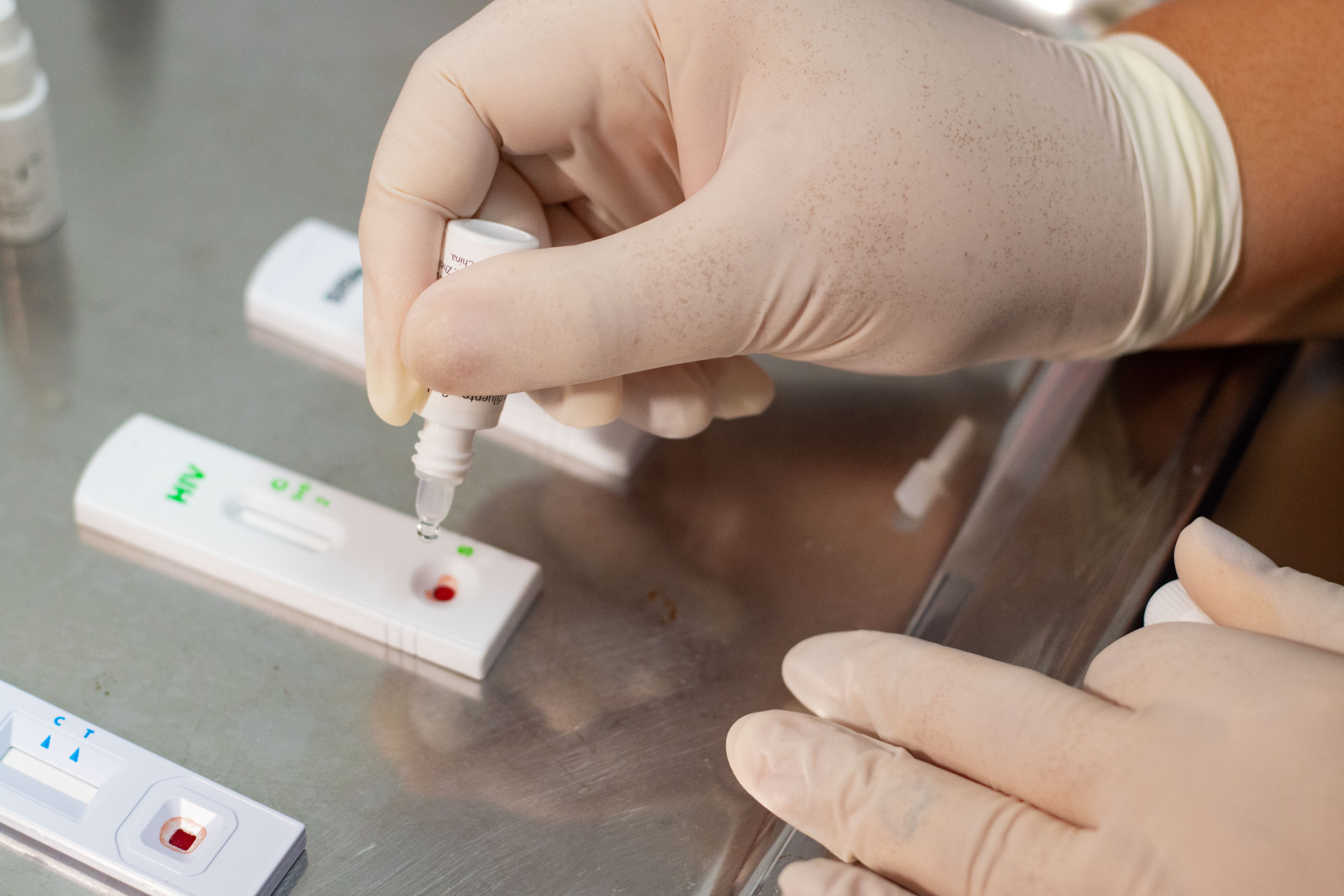 ￼TESTAGEM, preservativo e de profilaxias são formas de prevenir o HIV (Foto: Lorena Louise/Especial para O POVO, em 30/1/2025)