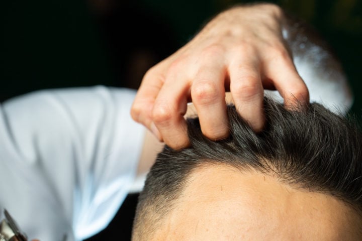 Há vários anos, a utilização de minoxidil para uso tópico sobre o couro cabeludo e/ou regiões com quedas de cabelo, como falhas na barba, parece estar consagrado e ter resultados comprovados sem efeitos colaterais significativos, explicou o cardiologista Soubihe Junior, ao g1.