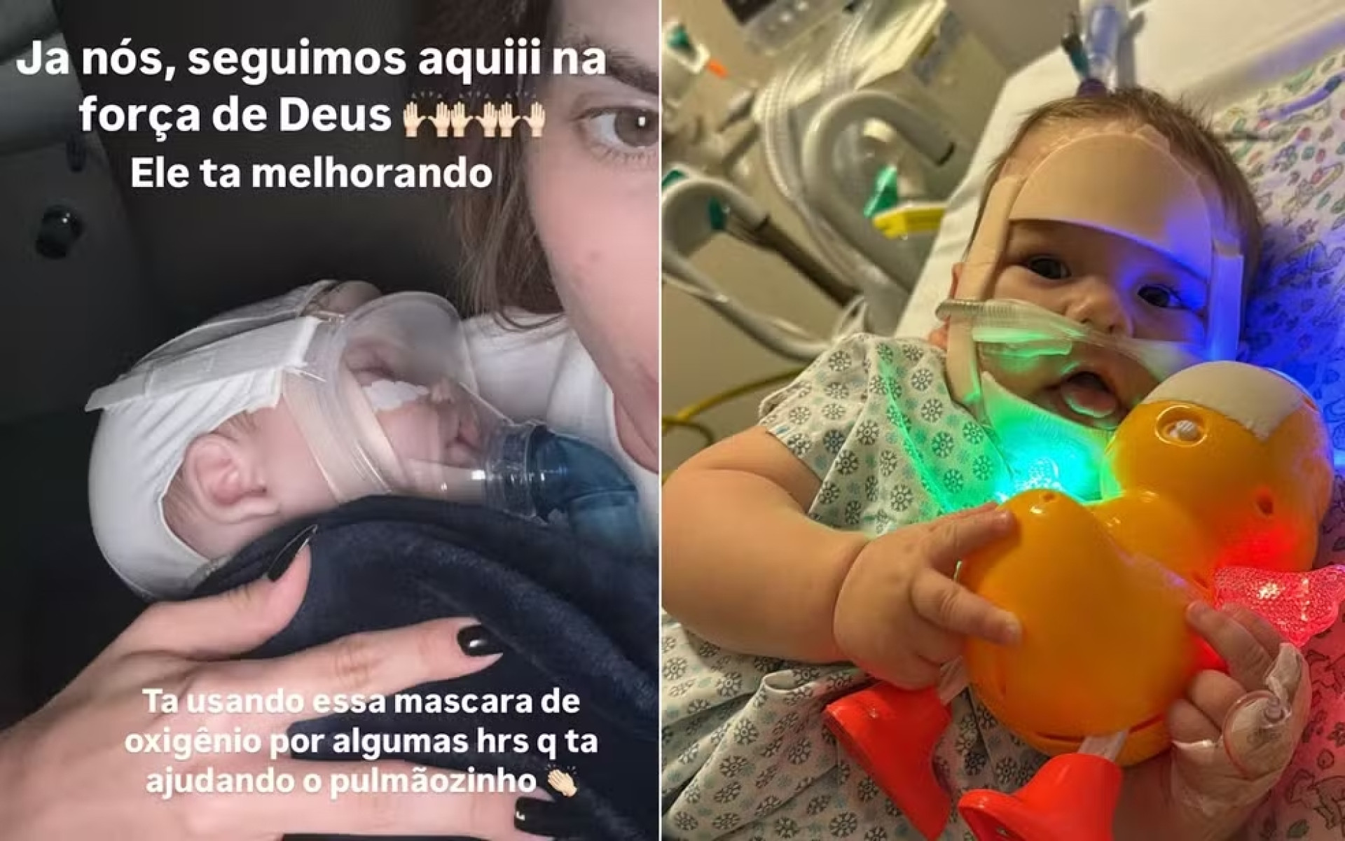 O ca&ccedil;ula n&atilde;o est&aacute; em estado grave, mas precisa de tratamento intensivo