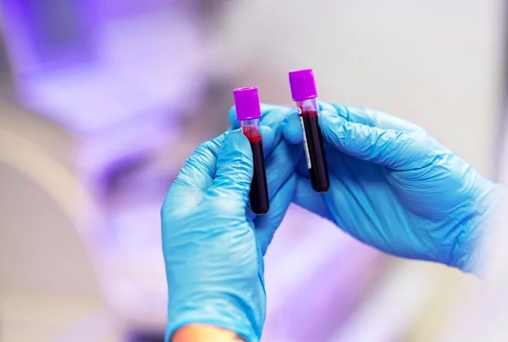 Essa condição acontece quando o tipo sanguíneo da mãe é incompatível com o do bebê.