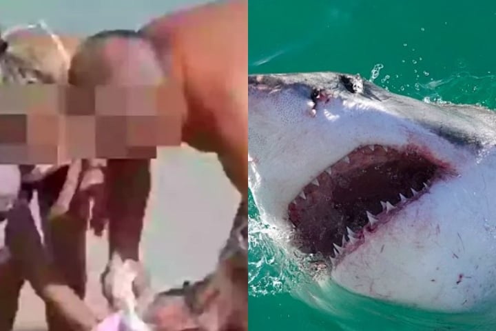 Uma mulher canadense de 55 anos perdeu as duas mãos após ser atacada por um tubarão enquanto praticava snorkel na praia de Thompson Cove Beach, no Caribe.