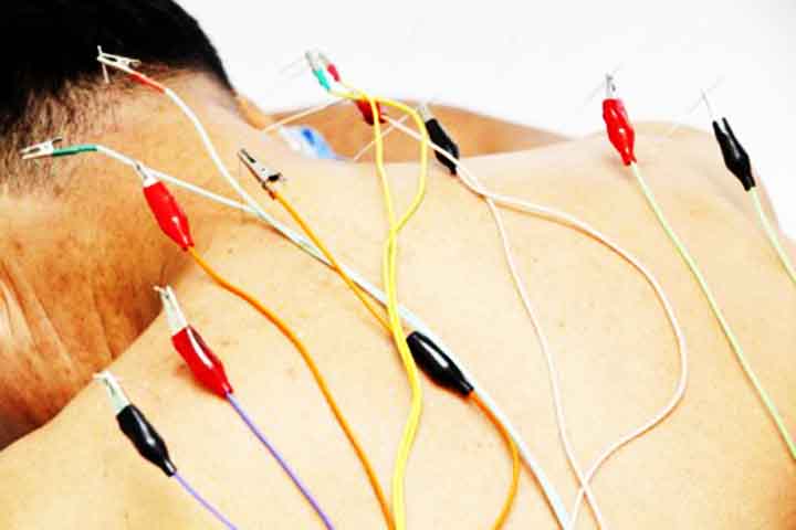 Os estímulos podem ser manuais ou elétricos, e cada sessão é personalizada conforme o diagnóstico do paciente. Além disso, a técnica pode ser combinada com fitoterapia e outros métodos terapêuticos.