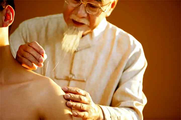 Países com forte tradição em acupuntura incluem China, Japão, Coreia do Sul e Vietnã, onde a técnica faz parte dos sistemas de saúde. 